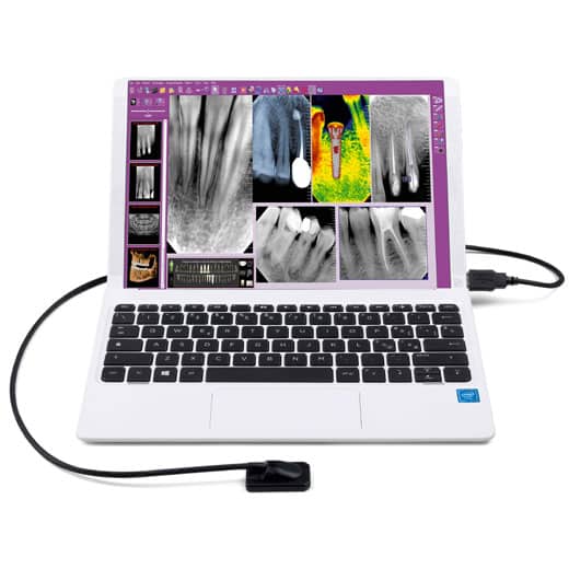 ZEN-X-PC MyRay Zen-X RVG senzor
