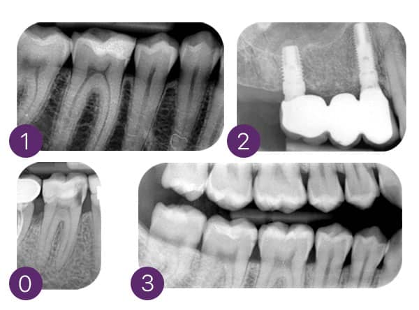 image1 MyRay Hy-Scan